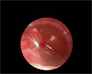ear nose throat specialist singapore ear nose throat specialist singapore