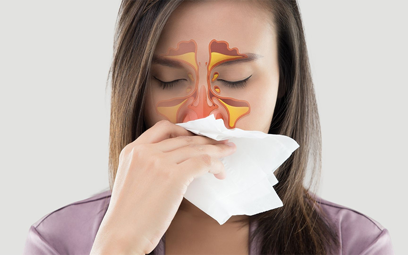 Sinusitis Treatment