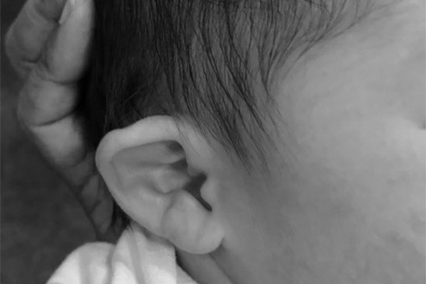 Ear Well - at Lynne Lim ENT Centre